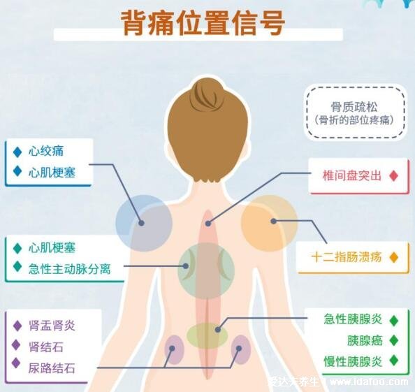 背部筋膜炎疼痛位置圖，身體背部各部位疼痛對比圖