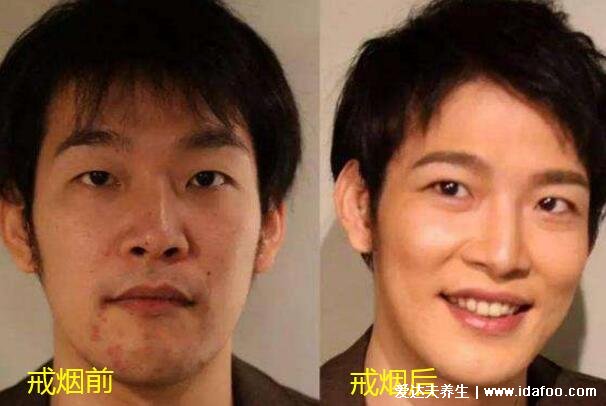戒煙1-30天身體變化，最明顯的是顏值變高人變精神