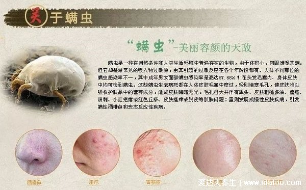 床上螨蟲咬的癥狀圖片，似蚊子包夜晚比白天瘙癢(螨蟲最怕這3種東西)