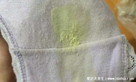 女人艾滋病的三大癥狀圖片，對比艾滋病初期小紅點照片自查