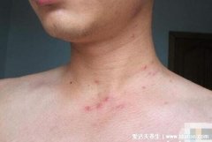 艾滋病的疙瘩的發展過程(女性艾滋病初期