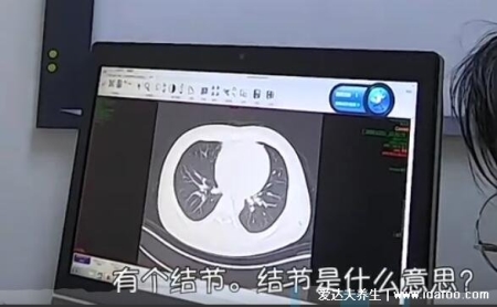 長期抽電子煙體檢報告出來了，出現多個良性肺部結節(警惕癌變)