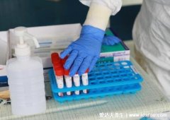自費做核酸檢測多少錢(自費藥品使用管理