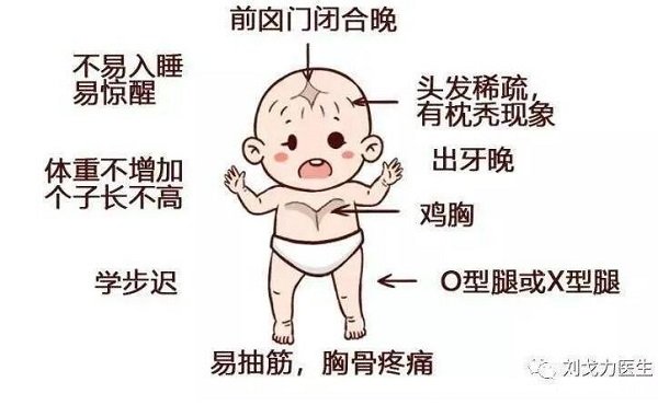 嬰兒佝僂病睡姿圖片，警惕骨骼發育的4種情況(平躺睡覺) 