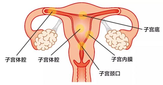以前流產可以檢查出來嗎 婦產科診斷報告能看出既往人流史嗎