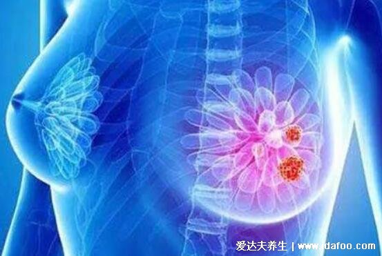 乳腺增生結節怎么調理最好方法，重點保持良好心態