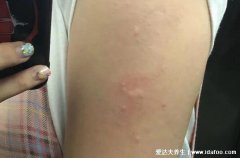 打完第三針疫苗胳膊疼(打完新冠第三針疫
