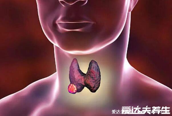 盡量不要和癌癥患者密切接觸，胃癌當心幽門螺旋桿菌傳染(4種癌) 