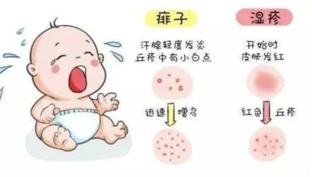 一張圖教你區別濕疹和痱子，從部位/癥狀/時間區分(濕疹時間長)