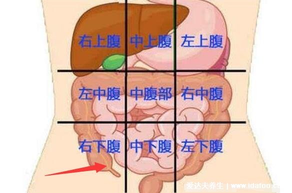 闌尾炎在左邊還是右邊疼痛位置圖片，右下腹肚臍周圍劇痛