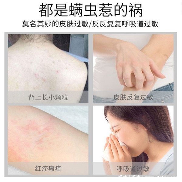 螨蟲過敏癥狀圖片，可打噴嚏等似感冒/被咬身上瘙癢(叮咬圖)