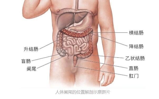 闌尾炎在左邊還是右邊疼痛位置圖片，右下腹肚臍周圍劇痛