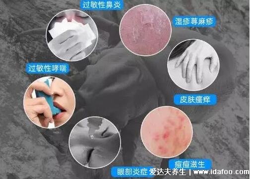 螨蟲過敏癥狀圖片，可打噴嚏等似感冒/被咬身上瘙癢(叮咬圖)