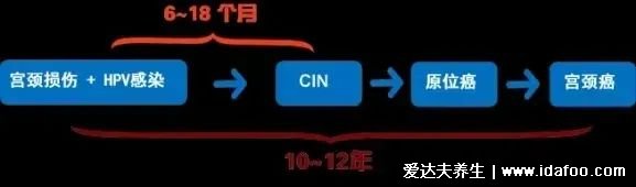 感染HPV病毒 就會惡變成宮頸癌嗎？造成宮頸癌的真正真相究竟是什么？