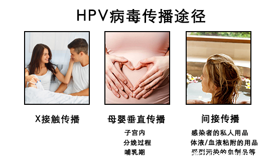 感染HPV病毒 就會惡變成宮頸癌嗎？造成宮頸癌的真正真相究竟是什么？