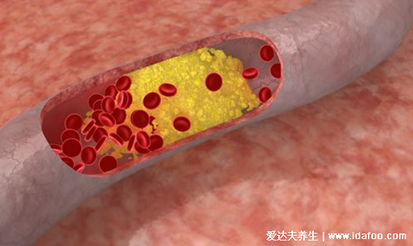 你還在減肥？體重低當心 5種病找上門