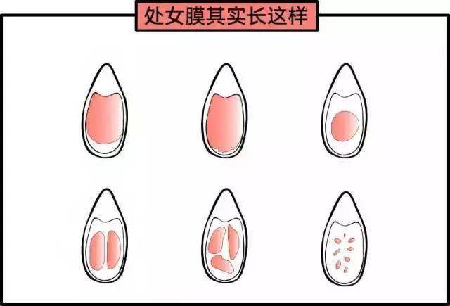 女性陰部真實照片：處于良好的狀態女人真實完美花園及處女膜解剖學圖片多圖