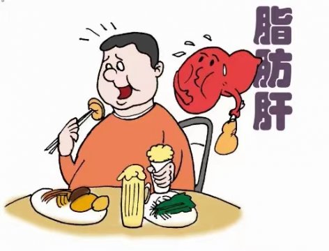 堅持三個護肝秘訣，有效改善肥胖性脂肪肝對身體的危害