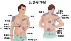 后背疼痛要警惕的三種病，后背疼痛圖片