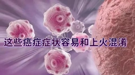 你以為是上火，可能是癌癥信號