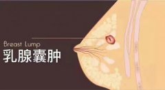 乳腺囊腫會變成乳腺癌嗎怎么治療(乳腺囊