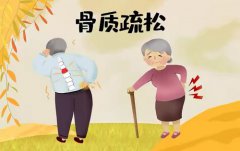 骨質疏松的最佳調理方法(如何預防骨質疏