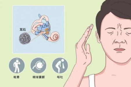 有一種眩暈叫耳石癥，符合這3條高度懷疑