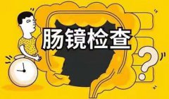 一般老百姓檢查身體都做腸鏡么(有這19類