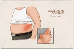 流行性感冒高發季節是哪個季節(呼吸道傳染病高發季節是什么時候)
